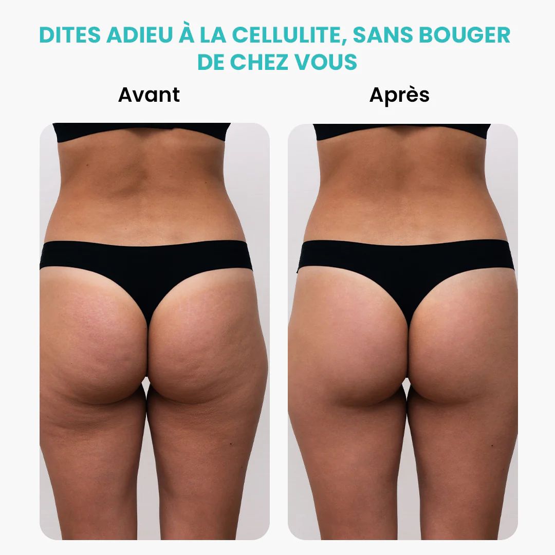 Appareil de Massage Minceur Électrique 3 en 1 ( vibro masseur /  anti cellulite / Brûleur de Graisse )